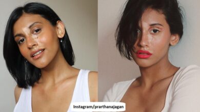 Prarthana Jagan Vitiligo