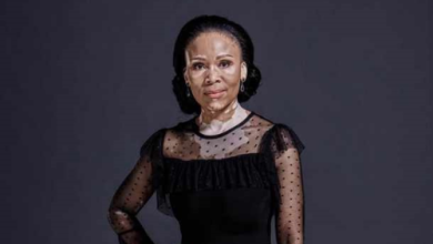 South African actress leleti khumalo vitiligo