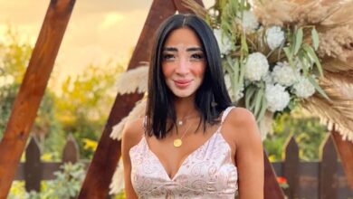 makeup artist vitiligo logina salah