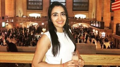 Ninu Galot Vitiligo woman UK