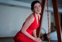 Aastha Shah Vitiligo woman India