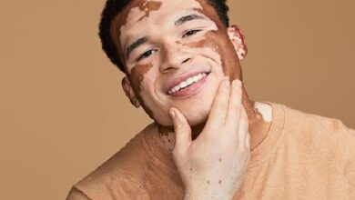 Vitiligo Male Model USA Curtis McDaniel
