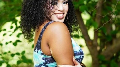 Vitiligo Model Dancer Mariah Perkins USA