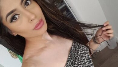 Vitiligo makeup artist london sonam rajal