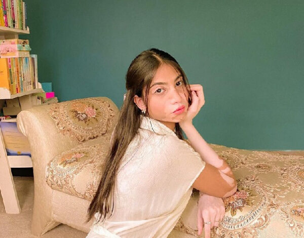 Vitiligo model Pakistan Javeria Raheel