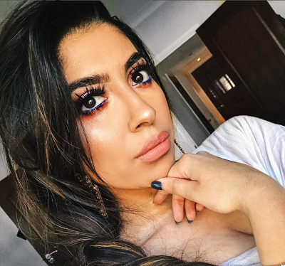 vitiligo beauty sonam rajal