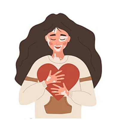 Self love is important for dating success with vitiligo