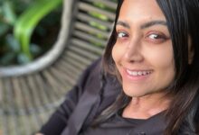 Indian Film Actress Mamta Mohandas Vitiligo