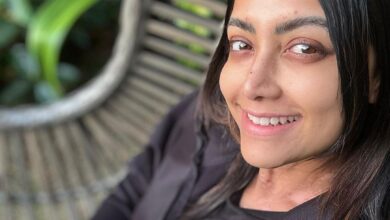 Indian Film Actress Mamta Mohandas Vitiligo